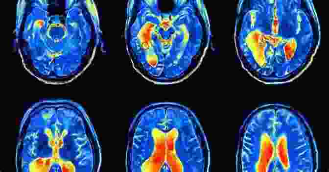 A Brain Scan Showing Activity In Multiple Brain Regions 50 Popular Beliefs That People Think Are True (50 Series)