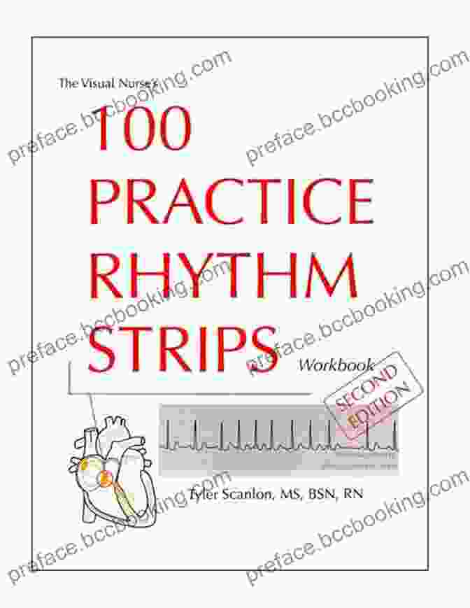 The Visual Nurse 100 Practice Rhythm Strips Workbook Cover The Visual Nurse S 100 Practice Rhythm Strips Workbook (The Visual Nurse S Basic ECG 2)